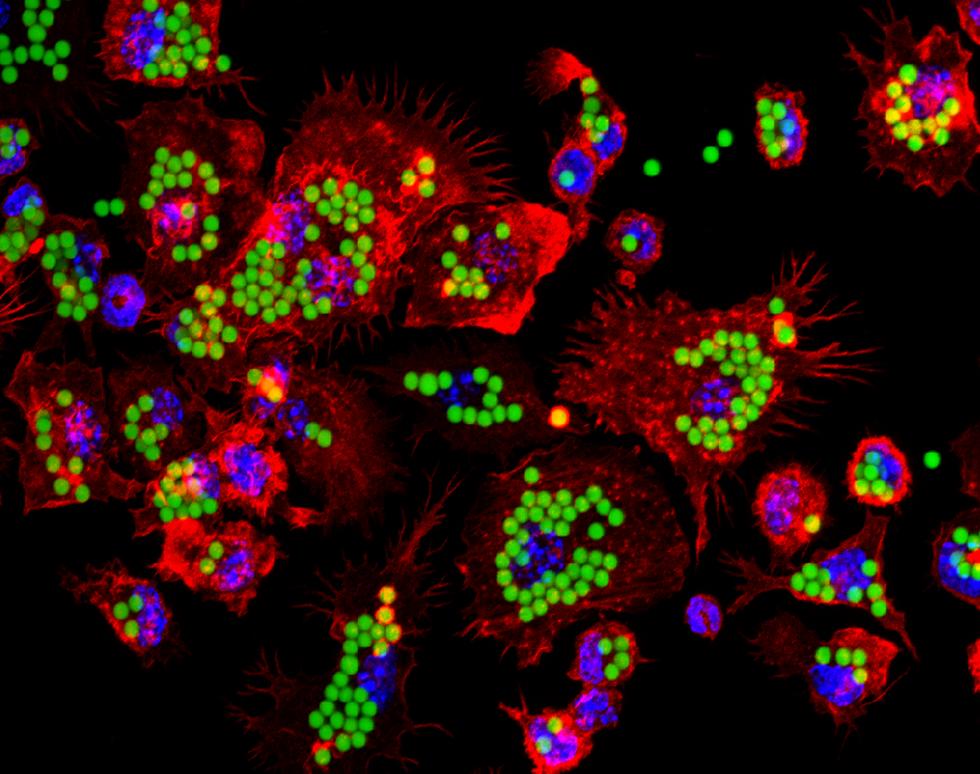 Actin - Alexanda Mant